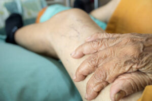 Hemoliv+ opiniones, foro, comentarios