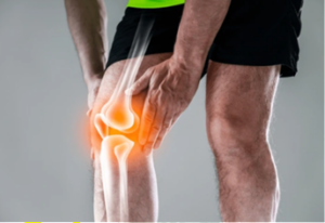 Arthrolix opiniones, foro, comentarios