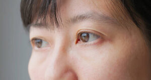 Opticular opiniones, foro, comentarios